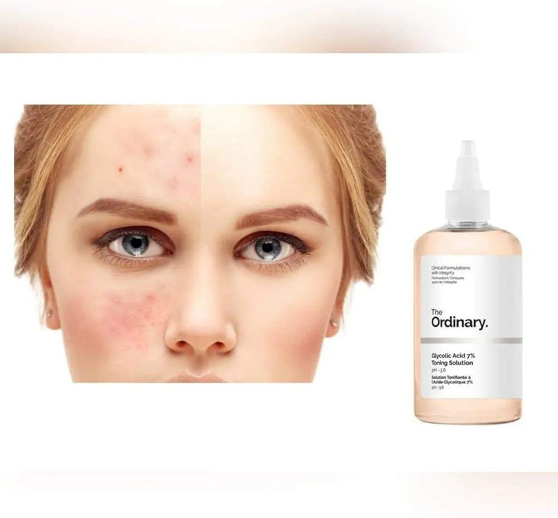 GLYCOLIC ACID 7% TONING SOLUTION – 240ML